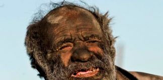 Ver para creer: La buena salud del hombre más "chancho" del mundo