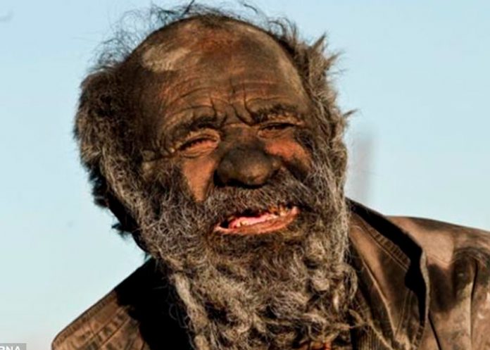 2.3 Ver para creer: La buena salud del hombre más