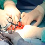 ¡Lo último! Dos riñones de cerdo son trasplantados con éxito a un humano ¡Lo último! Dos riñones de cerdo son trasplantados con éxito a un humano