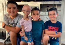 Fallece youtuber que inspiró la película «El curioso caso de Benjamin Button» Fallece youtuber que inspiró la película "El curioso caso de Benjamin Button"