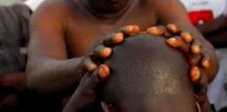 Decapitan a calvo por creer que su cabeza “tenía oro” en África