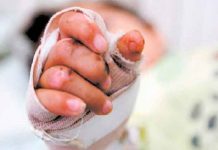 Escondían a su hijo quemado por pólvora para evitar ser multados en Colombia Escondían a su hijo quemado por pólvora para evitar ser multados en Colombia