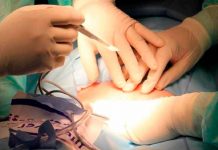 Mujer vivió con tijera quirúrgica dentro del abdomen ¡durante 20 años! en Bangladesh