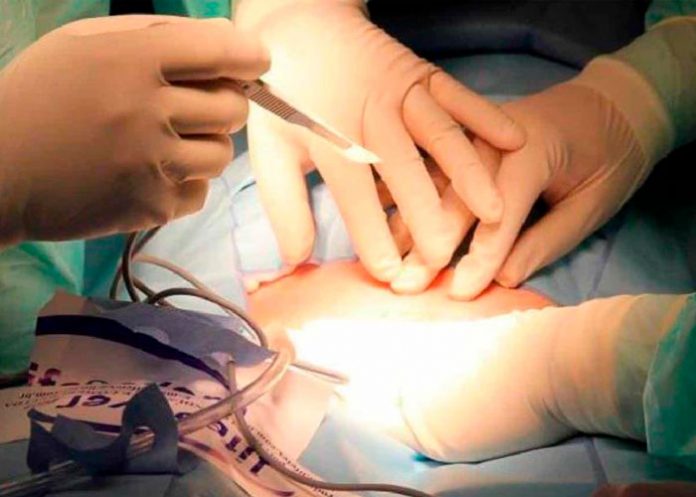 Mujer vivió con tijera quirúrgica dentro del abdomen ¡durante 20 años! en Bangladesh