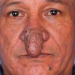 No más bullying para sujeto que se operó su nariz en forma de falo (IMÁGENES)