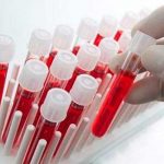 Crean el primer test de sangre capaz de detectar una variedad de cáncer Crean el primer test de sangre capaz de detectar una variedad de cáncer