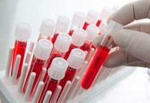 Crean el primer test de sangre capaz de detectar una variedad de cáncer