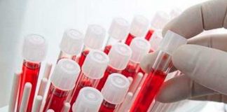 Crean el primer test de sangre capaz de detectar una variedad de cáncer