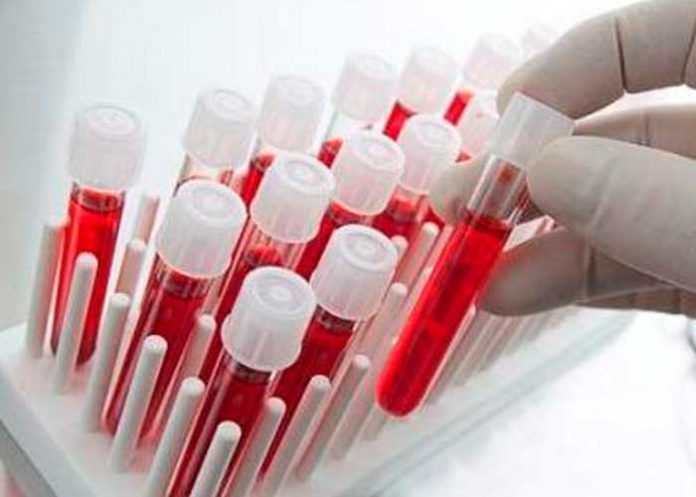 salud1 Crean el primer test de sangre capaz de detectar una variedad de cáncer