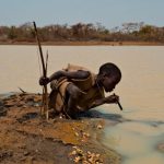 Reportan 14 casos del misterio y alarmante gusano de Guinea Reportan 14 casos del misterio y alarmante gusano de Guinea