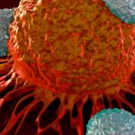 Estas son las diferencia entre un tumor y el cáncer Estas son las diferencia entre el tumor y el cáncer.