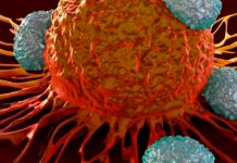 Estas son las diferencia entre un tumor y el cáncer Estas son las diferencia entre el tumor y el cáncer.