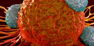 Estas son las diferencia entre el tumor y el cáncer.