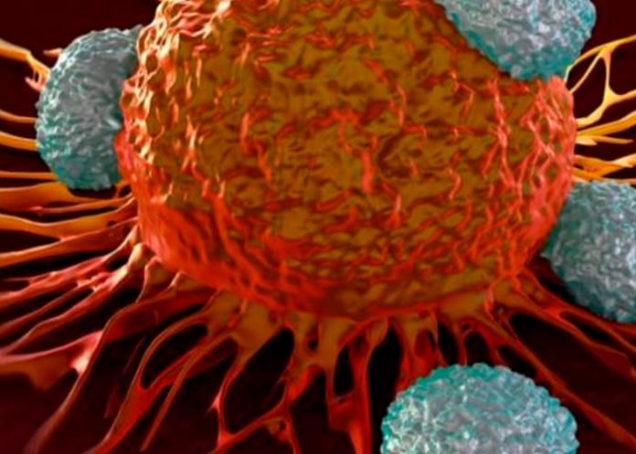 Estas son las diferencia entre el tumor y el cáncer.