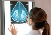 Científicos crean un fármaco que frena la metástasis en cáncer de mama