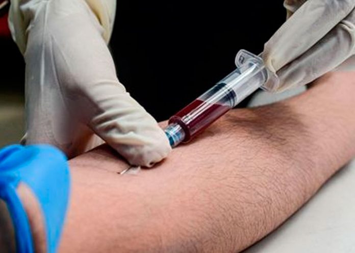 Existe nueva variante más contagiosa del VIH según científicos