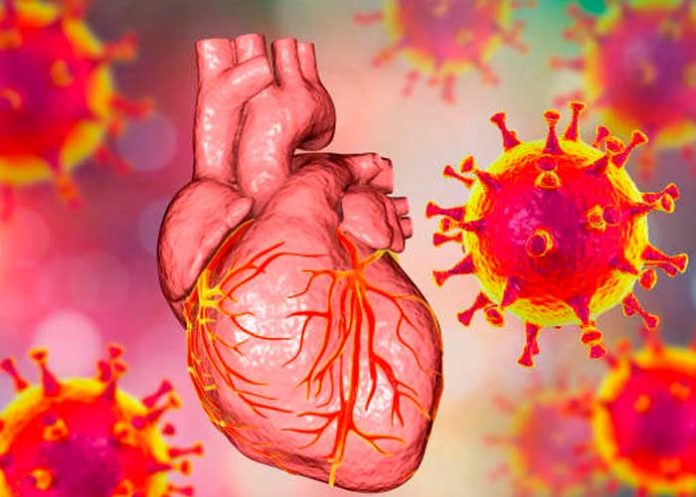 Problemas cardíacos por COVID-19