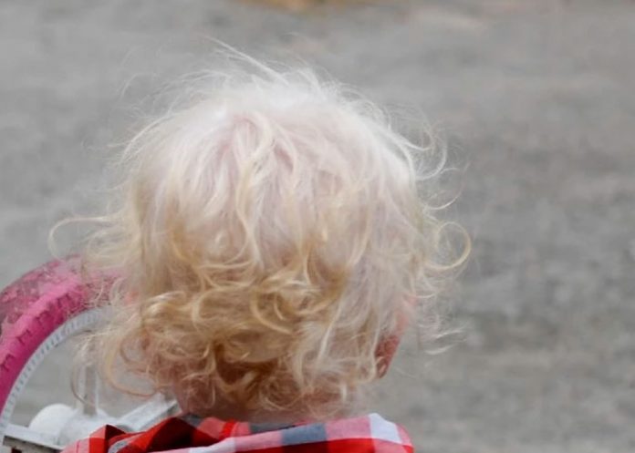 africa1 Tragedia: niño albino desmembrado en África tras prácticas de brujería