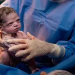 La bebé más enojada del mundo se reencuentra con fotógrafo que la hizo viral