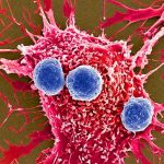 Brasil autoriza primer tratamiento génico CAR-T contra el cáncer Brasil autoriza primer tratamiento génico CAR-T contra el cáncer