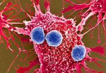 Brasil autoriza primer tratamiento génico CAR-T contra el cáncer Brasil autoriza primer tratamiento génico CAR-T contra el cáncer