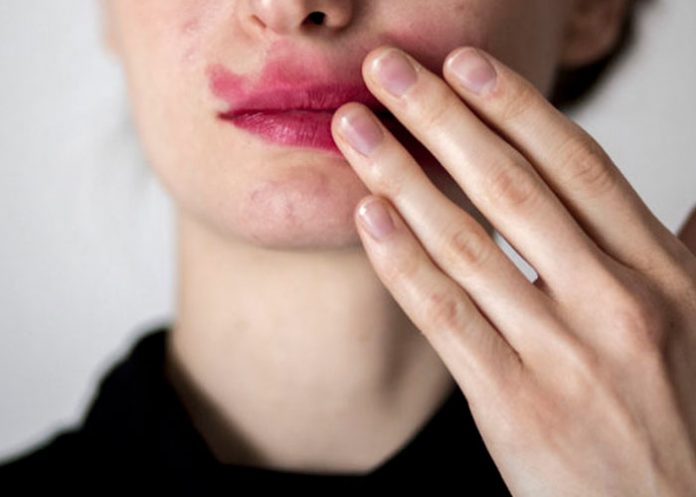 ecuador1 Machismo opresor: Casi la mata porque la mujer no tenía la cena en España