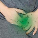 Moderna trabaja en el desarrollo de una vacuna contra el herpes