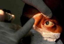 Aumentan a 31 los casos de hongo negro en Honduras