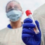 Reportan casos de fiebre de Lassa en Reino Unido, virus similar al ébola