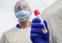 Reportan casos de fiebre de Lassa en Reino Unido, virus similar al ébola Reportan casos de fiebre de Lassa en Reino Unido, virus similar al ébola