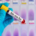 ¡Nuevo peligro! Confirman el primer caso de poliovirus salvaje de África