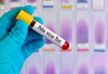 ¡Nuevo peligro! Confirman el primer caso de poliovirus salvaje de África ¡Nuevo peligro! Confirman el primer caso de poliovirus salvaje de África