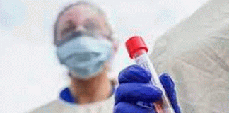 Reportan casos de fiebre de Lassa en Reino Unido, virus similar al ébola