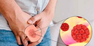 El virus del papiloma humano puede causar cáncer en los hombres.