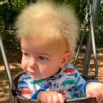 Síndrome del cabello rebelde, rara afección que afecta a Lock