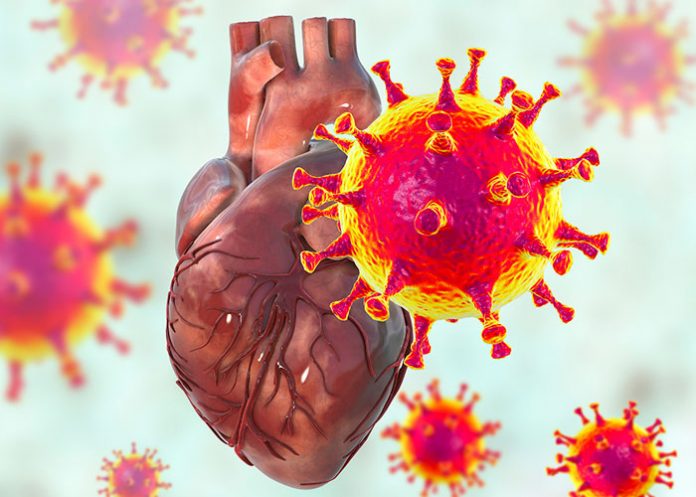 2 Problemas cardíacos después del Covid-19