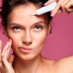 ¿Por qué me salen granos en la frente y cómo puedo eliminarlos? ¿Por qué me salen granos en la frente y cómo puedo eliminarlos?