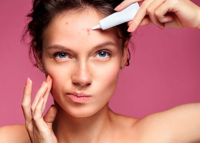 2 ¿Por qué me salen granos en la frente y cómo puedo eliminarlos?