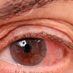 ¿Cómo podemos prevenir el glaucoma?, ¡Aquí te contamos! ¿Cómo podemos prevenir el glaucoma?, ¡Aquí te contamos!