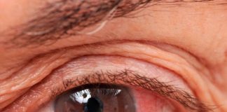 ¿Cómo podemos prevenir el glaucoma?, ¡Aquí te contamos!