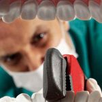 Dentista culpable de haber dañado dientes a miles de pacientes en EE.UU Dentista culpable de haber dañado dientes a miles de pacientes en EE.UU