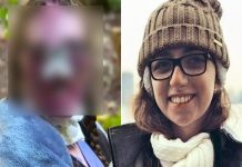 Joven que fue mordida por dos perros queda con el rostro desfigurado