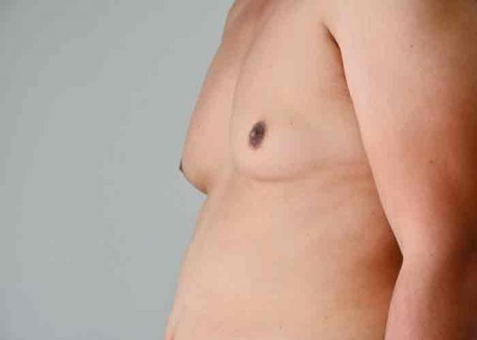 Joven dominicano con senos de mujer denuncia acoso y burla