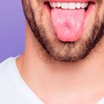 ¡Qué asqueroso! Aterrador caso de un hombre con pelo en la lengua