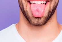 ¡Qué asqueroso! Aterrador caso de un hombre con pelo en la lengua ¡Qué asqueroso! Aterrador caso de un hombre con pelo en la lengua