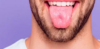 ¡Qué asqueroso! Aterrador caso de un hombre con pelo en la lengua