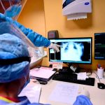 ¡Cálmese señora! Mujer vivió por años con un vaso atorado en su vejiga ¡Cálmese señora! Mujer vivió por años con un vaso atorado en su vejiga