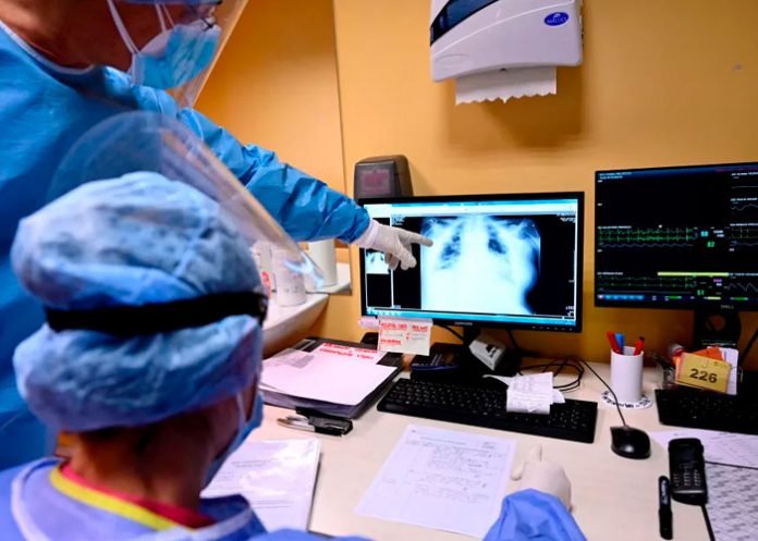 ¡Cálmese señora! Mujer vivió por años con un vaso atorado en su vejiga