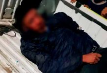 ¡Hartos de la delincuencia! Vecinos cortan los dedos de un motociclista Vecinos cortan los dedos de un motociclista acusado de robo