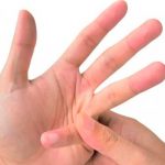 ¿Tronarse los dedos es malo? Aquí te contamos todo sobre eso ¿Tronarse los dedos es malo? Aquí te contamos todo sobre eso